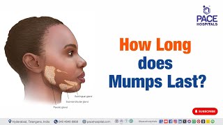 Mumps Last  How Long does Mumps Last  mumps shorts viralvideo [upl. by Enaenaj]