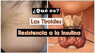 Tiroides y Resistencia a la insulina  Mente de Mujer por Carolina HD [upl. by Chloras826]