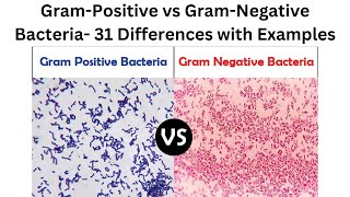 Gram Positive vs Gram Negative Bacteria 31 Differences with Examples [upl. by Ellerehc171]