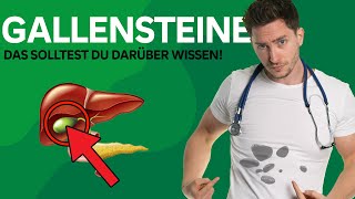 Was sind eigentlich Gallensteine [upl. by Aurelius]