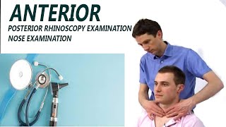 ANTERIOR  POSTERIOR RHINOSCOPY EXAMINATION NOSE EXAMINATION [upl. by Scuram]