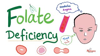 Folate deficiency  Megaloblastic Anemia  Macrocytic  Hematology Series [upl. by Farhsa]