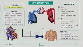 Cardiología  Valvulopatías estenosis aórtica insuf aortica estenosis mitral [upl. by Waverley58]