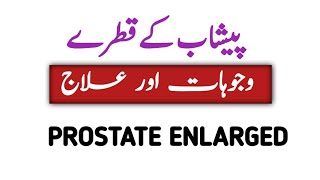 prostate gland and urinary problemsenlarged prostareBPHپراسٹیٹ [upl. by Adnaluoy]