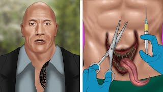 ASMR Help The Rock remove Venom from his navel  Satisfying [upl. by Suellen853]