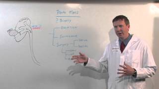 Treatments for Kidney Tumors  Kenneth Nepple MD [upl. by Aidualc]