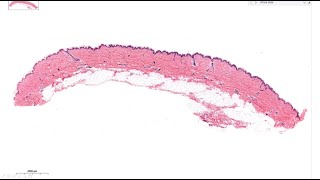 Histology  Stratified Epithelial Tissue [upl. by Harelda476]