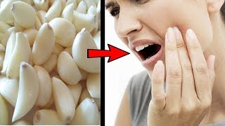 10 Home and Natural Remedies for Toothache Pain [upl. by Zahavi]