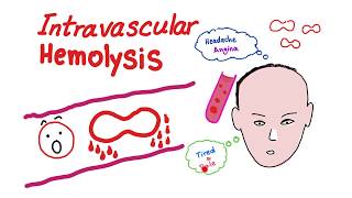 Intravascular Hemolysis [upl. by Stolzer]