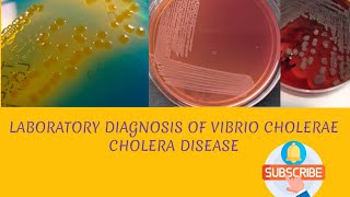 Laboratory diagnosis of Vibrio cholerae in hindi [upl. by Celeste]