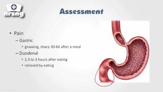 PUD Peptic Ulcer Disease Nursing NCLEX® Review  NRSNGacademycom [upl. by Yesac]