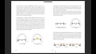 Manual básico de ortodontia e mecânica em typodomt [upl. by Ainex397]