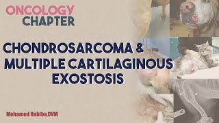 chondrosarcoma amp MCE lecture 3 [upl. by Assyn]