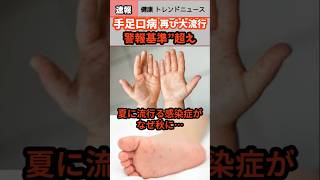 【健康 トレンド ニュース】再び大流行手足口病ヘルス 感染 ウェルネス 大流行 shorts NEWS health 流行 手足口病 急増 健康 sns 雑学 拡大 [upl. by Nelrac]