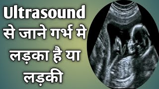 Ultrasound se kaise pta kre ki baby boy h kya baby girl  Ultrasound during pregnancy [upl. by Ilat]