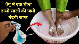 गर्दन हाथ पैर की सालों पुरानी जमी मैल को साफ कर गोरा कर देगी  Dark Neck Hand amp Feet Whitening [upl. by Narej]