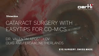 Showcase Cataract surgery with easyTips for COMICS by Valentin Apostolov [upl. by Melleta]