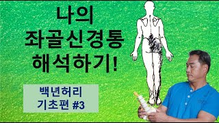 나의 좌골신경통 해석하기 백년허리 기초편3 [upl. by Viens]