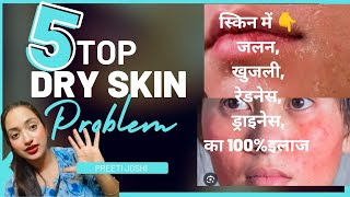 स्किन में 👉 खुजलीRedness जलनDrynessका १०० असरदार Tips amp Treatment [upl. by Elyrpa]