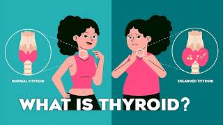 Thyroid Gland T3 T4 Thyroid Hormones and Thyroid Problems Animation thyroid [upl. by Noby]