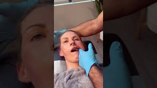 PAINFUL TMJ JAW TREATMENT 😥 [upl. by Sergent256]