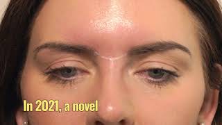 HowTo Treat The Glabella With Botox  3 Point Injecting Technique  Dr Chris Hutton [upl. by Yojal]