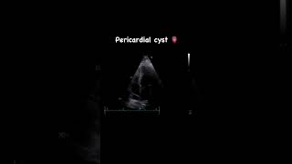 A pericardial cyst in echocardiography 💖 [upl. by Carbo724]