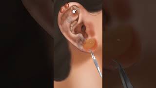 5item ear cleaning amp earring set asmr treatment [upl. by Kassi]