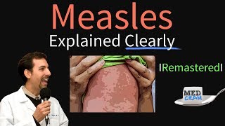 Measles Symptoms Diagnosis Vaccine Treatment Explained [upl. by Marilyn]