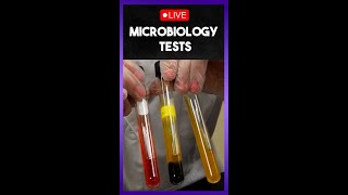 🔴 Microbiology Lab Test 👨‍🔬🦠🔍  Live [upl. by Mayram203]