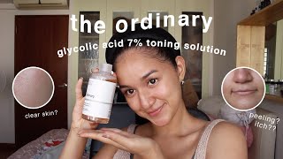 the ordinary glycolic acid toner 1 MONTH review w BEFOREAFTER [upl. by Mayram435]