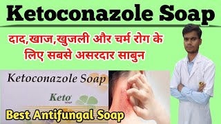 keto soap uses in hindi  Ketoconazole soap uses in hindi  ketofast soap  fungal infection का इलाज [upl. by Hanzelin]