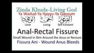 Rectal  Anal Fissure say Shifa [upl. by Nylsirhc135]