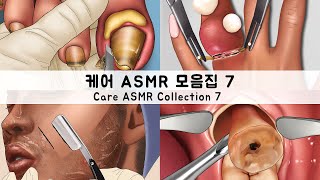 ASMR 케어 애니메이션 모음집7 내성발톱머릿니충치사랑니  CARE ANIMATION COLLECTION7 Ingrown toenailshead licecavities [upl. by Tj551]