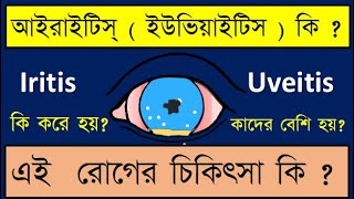 anterioruveitis iritis Iritis or Anterior uveitis symptoms signs and treatment discussed [upl. by Naneek]