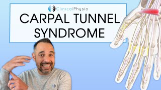 What Is Carpal Tunnel Syndrome  UPMC [upl. by Enilkcaj]