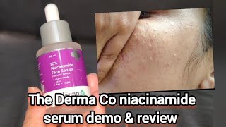 The Derma Co niacinamide serum demo amp review  how to use niacinamide serum rRmivlogs53 [upl. by Nesto]