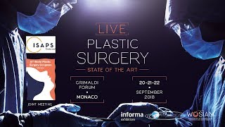 LIVE PLASTIC SURGERY  STATE OF THE ART [upl. by Ignace]