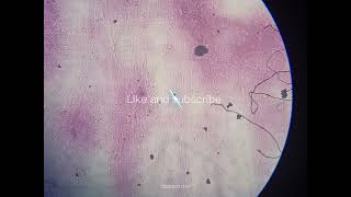 Nerve cells Histology [upl. by Yrellav]