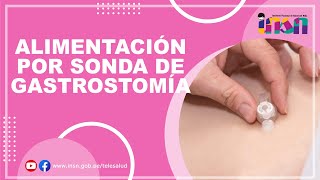 Alimentación por Sonda de Gastrostomía  Telecapacitación INSN [upl. by Martinson]