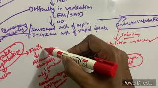 ASA 2022 Difficult airway algorithm in adults [upl. by Ixel]