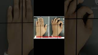 Hand x ray positioning short video [upl. by Egin]