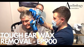 TOUGH EAR WAX REMOVAL IT TOOK BOTH OF US TO REMOVE   EP900 [upl. by Levitus]