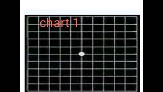 amsler test [upl. by Bernhard]