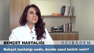 Behçet hastalığı nedir deride nasıl belirti verir [upl. by Ennayram]