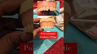 Polychromatic Cosmetic Composite Filling Workshop attended  Cosmetic Dentist Doc Taj dentist [upl. by Hazel]