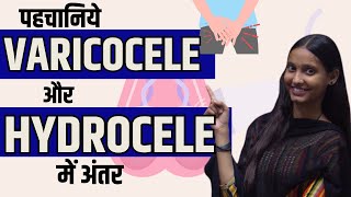 पहचानिये VARICOCELE और HYDROCELE में अंतर vericocele hydrocele  कारण  लक्षण  इलाज [upl. by Medlin]