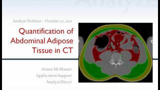 Quantification of Abdominal Adipose Tissue from CT using Analyze 100  Webinar [upl. by Beker]