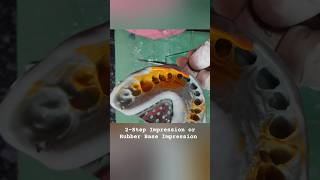 Rubber Base Impression or 2 step Impression dentalvideos dentist dentalvlog prosthodontics [upl. by Ayifas]