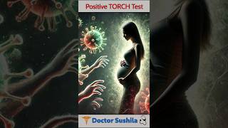 What Does a Positive TORCH Test Mean😰 Understanding IgG amp IgM Antibodies  torchtest antibodies [upl. by Merrill]